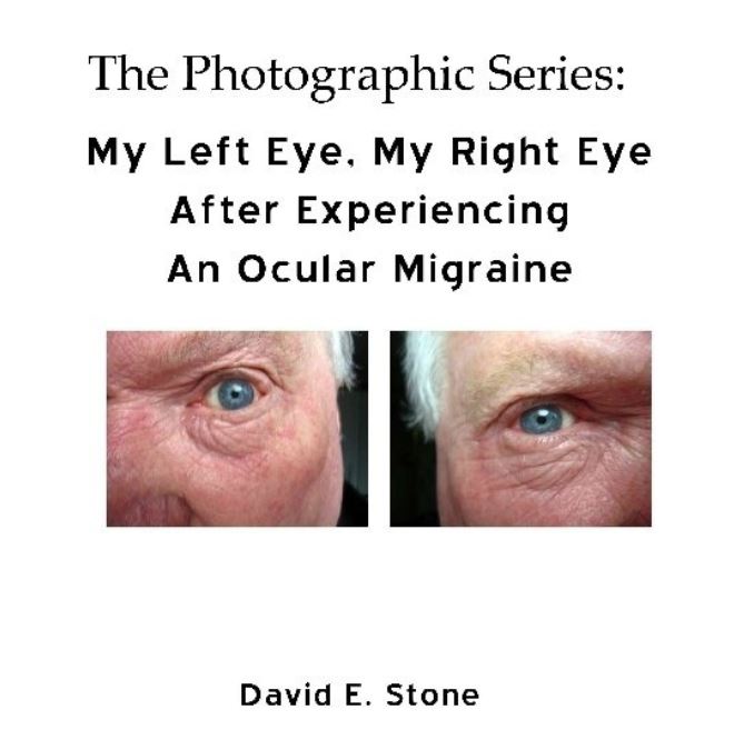 Cover of My Left Eye_My Right Eye_After Experiencing An Ocular Migraine